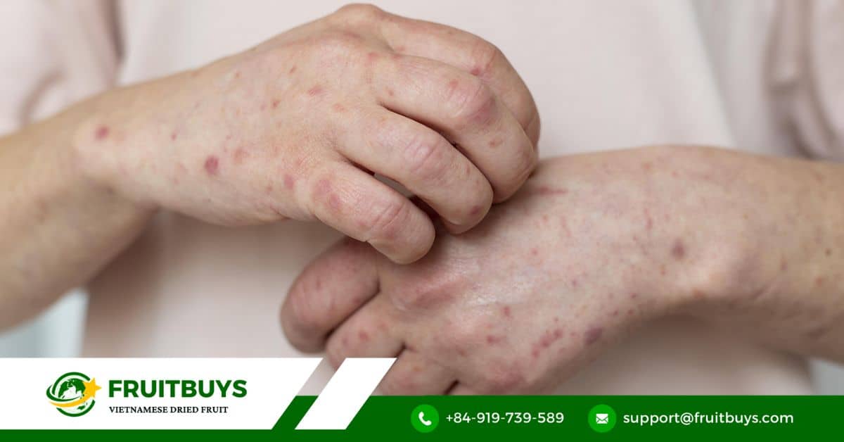 fruitbuys vietnam allergic reactions Allergic Reactions